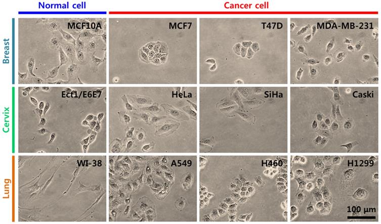 J Cancer Image