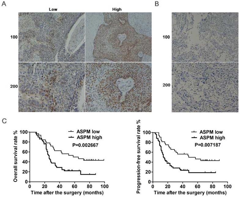 J Cancer Image