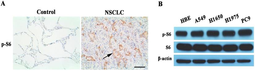 J Cancer Image