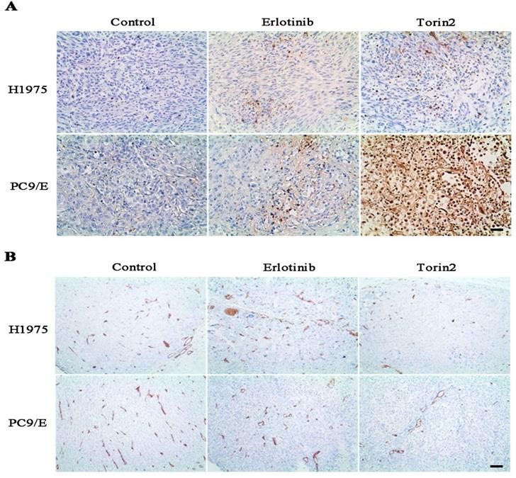 J Cancer Image