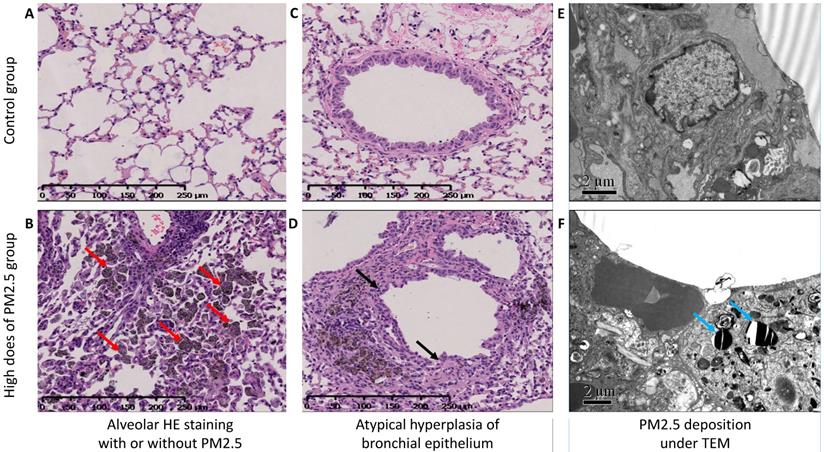 J Cancer Image