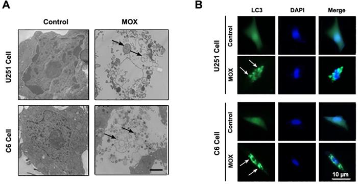 J Cancer Image