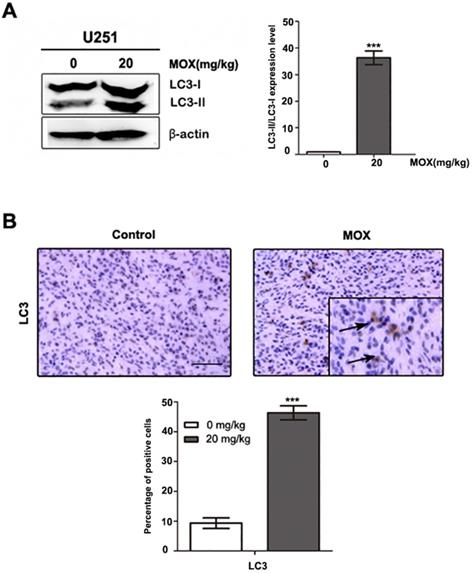 J Cancer Image