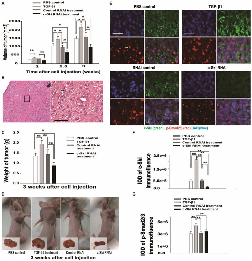 J Cancer Image