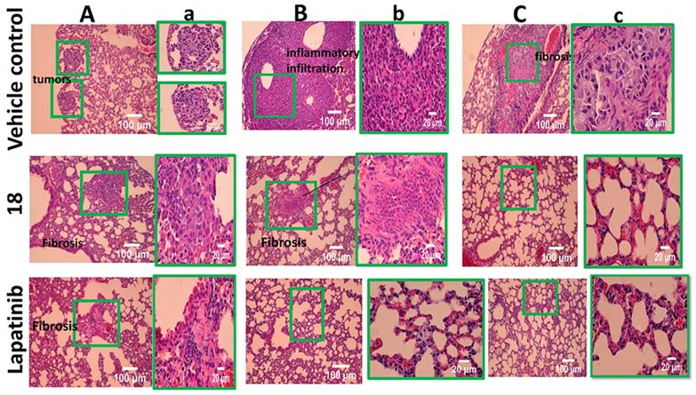 J Cancer Image