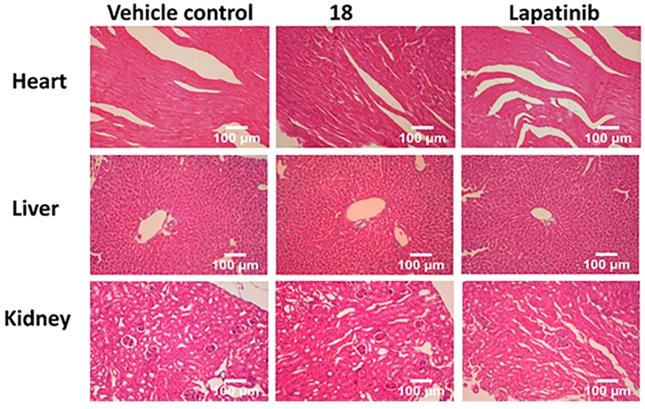 J Cancer Image