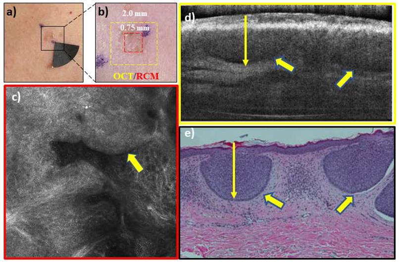 J Cancer Image