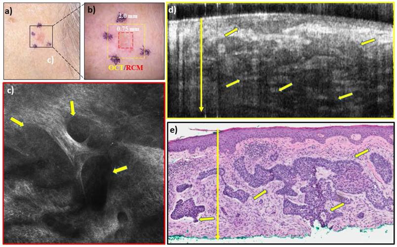 J Cancer Image