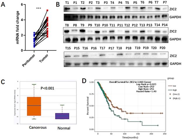 J Cancer Image