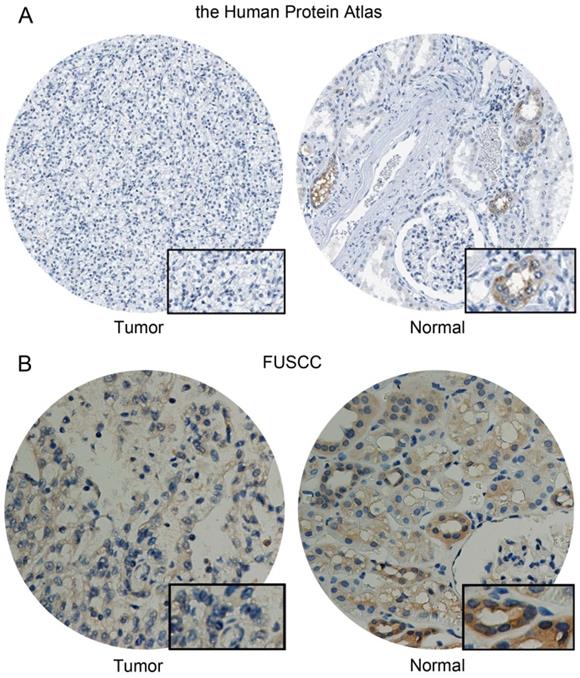 J Cancer Image