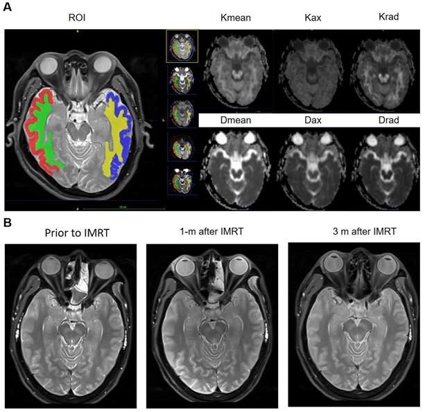 J Cancer Image