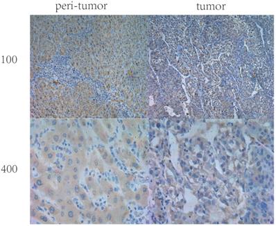 J Cancer Image