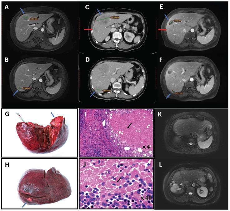 J Cancer Image