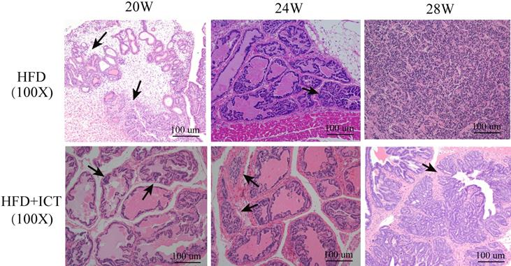 J Cancer Image