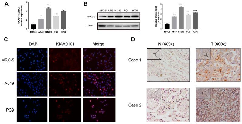 J Cancer Image