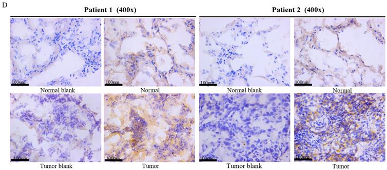 J Cancer Image