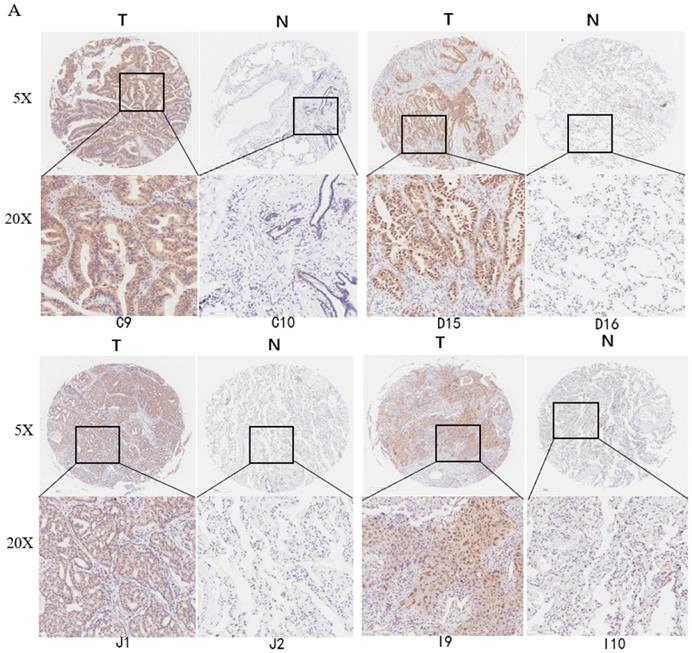 J Cancer Image