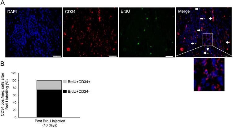 J Cancer Image