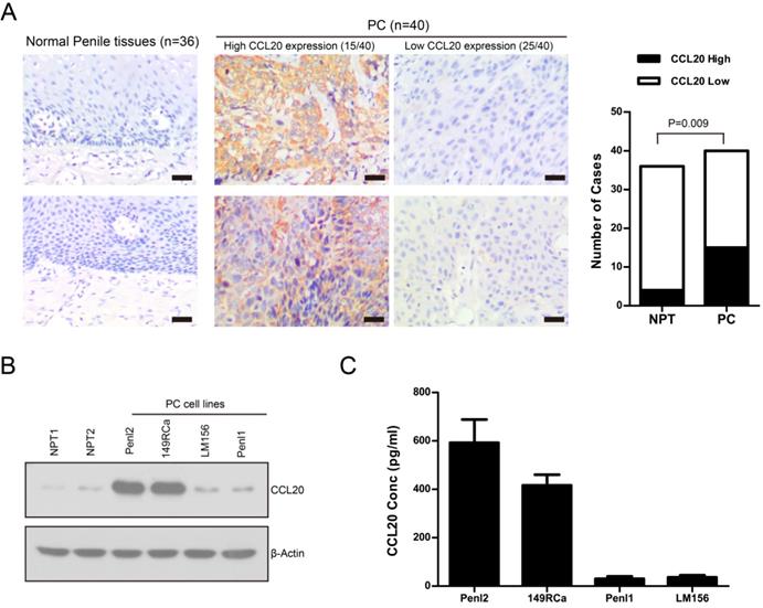 J Cancer Image