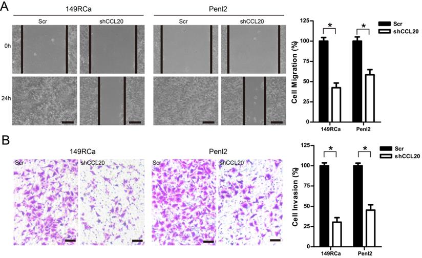 J Cancer Image