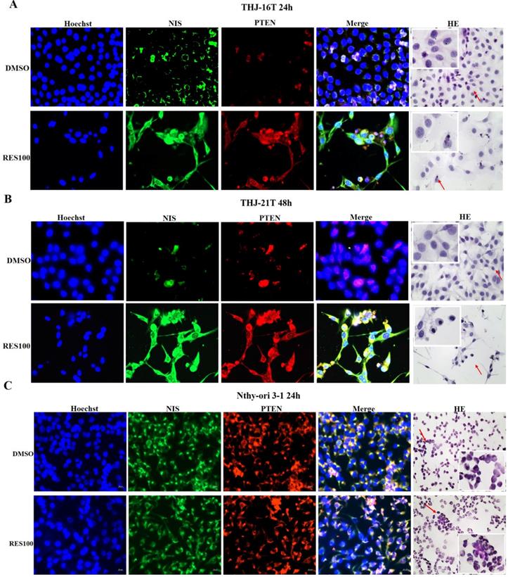 J Cancer Image