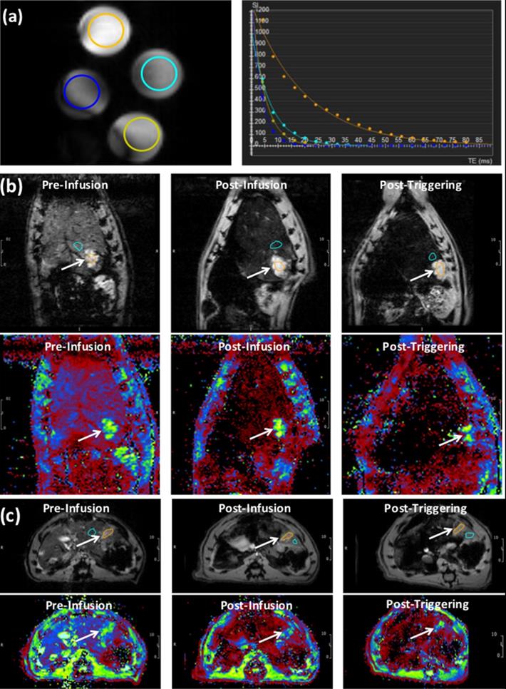 J Cancer Image