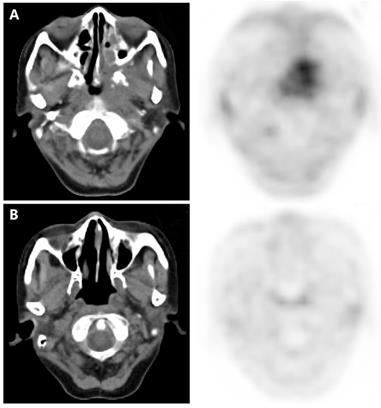 J Cancer Image