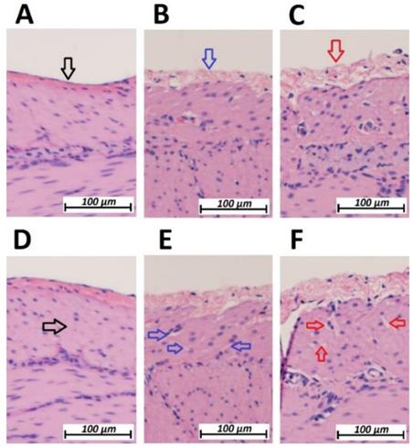 J Cancer Image