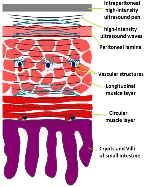 J Cancer Image