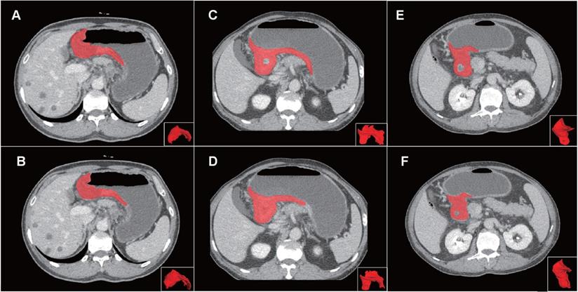 J Cancer Image