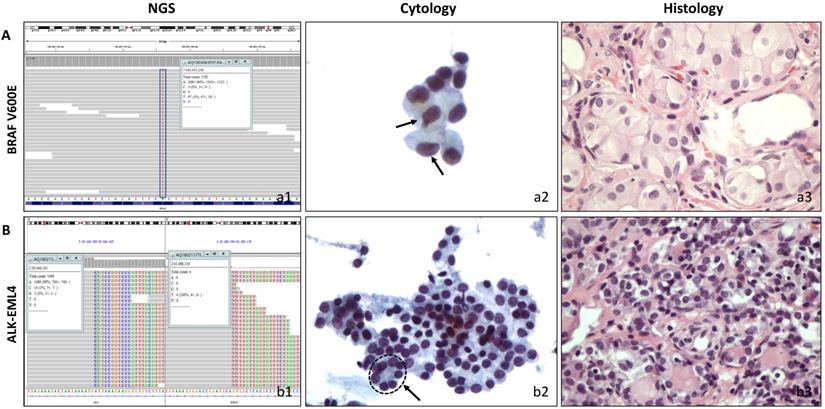 J Cancer Image