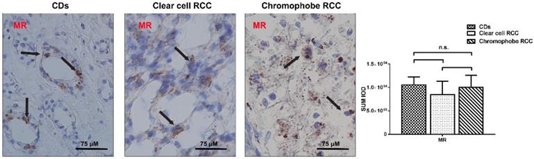 J Cancer Image