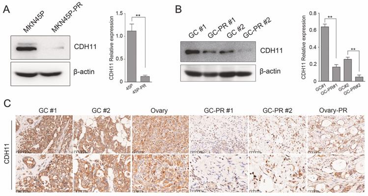 J Cancer Image