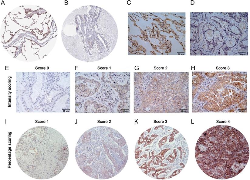 J Cancer Image