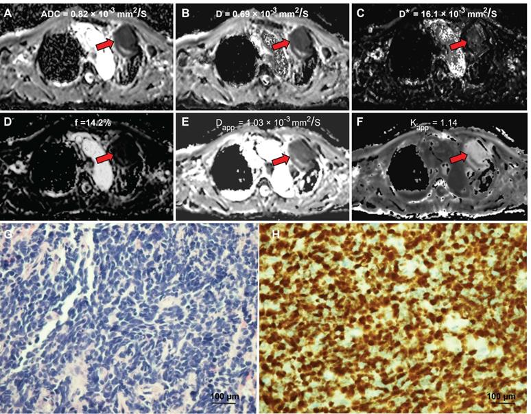 J Cancer Image