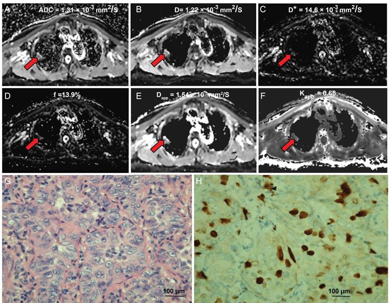 J Cancer Image