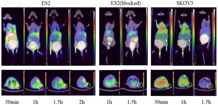 J Cancer Image