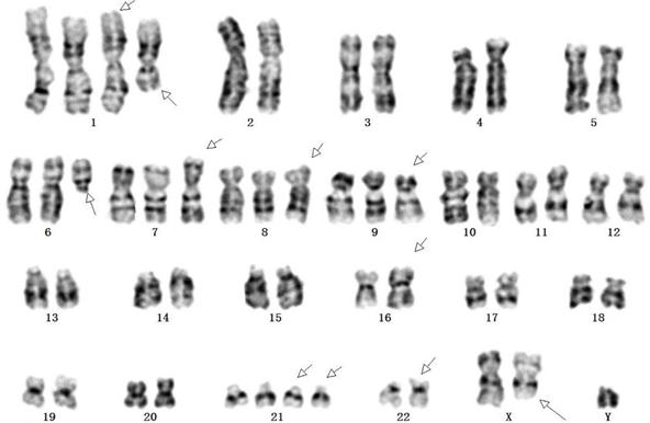 J Cancer Image