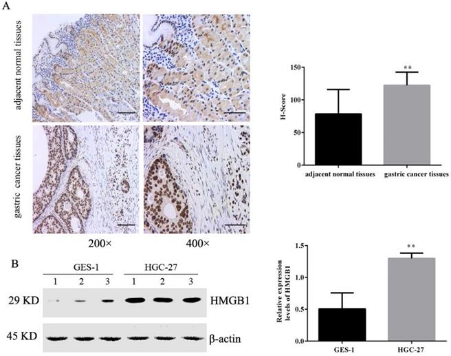 J Cancer Image