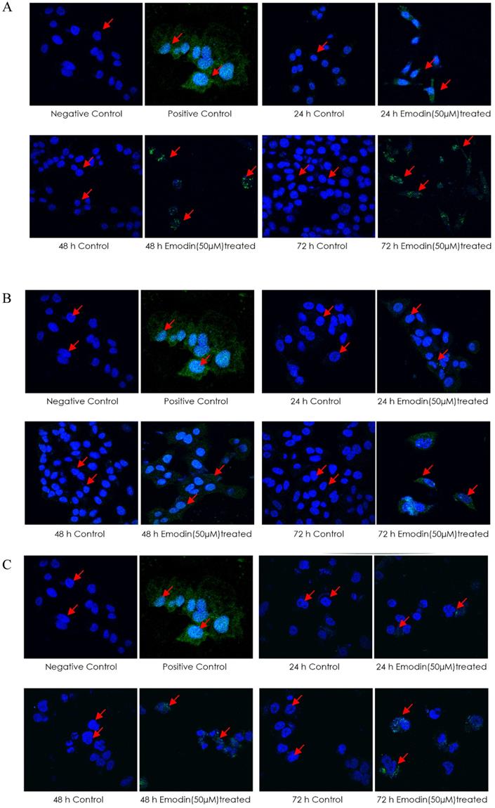 J Cancer Image