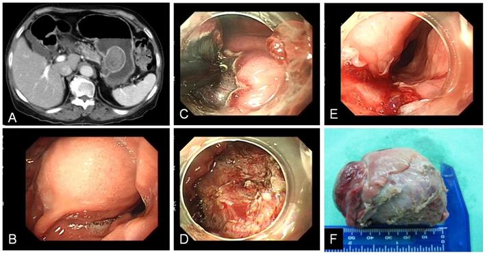 J Cancer Image