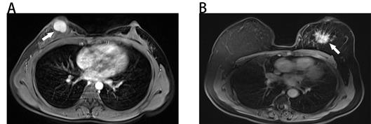 J Cancer Image