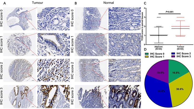 J Cancer Image