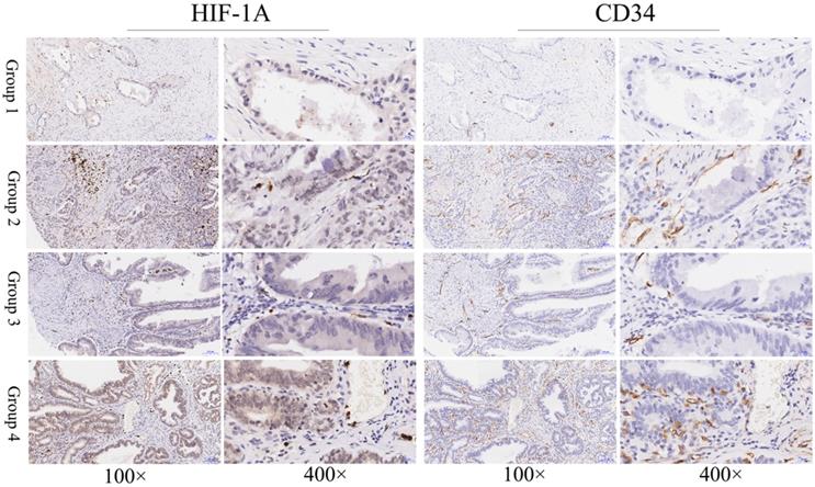 J Cancer Image