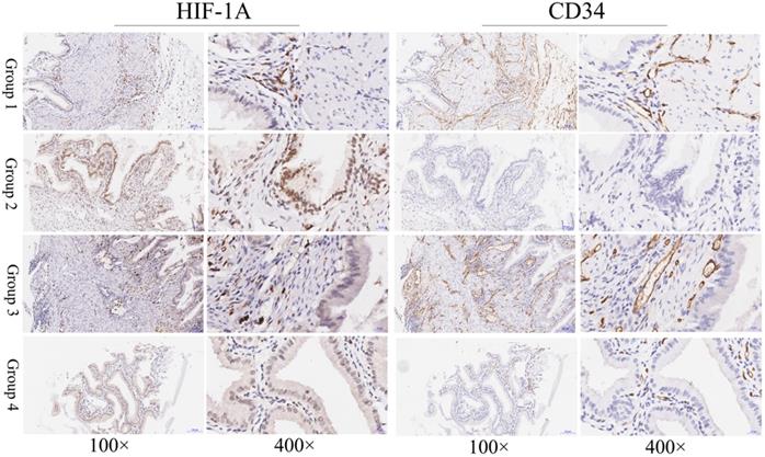 J Cancer Image