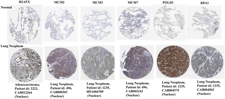 J Cancer Image