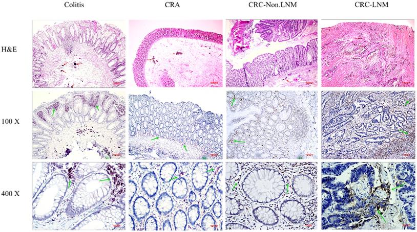 J Cancer Image