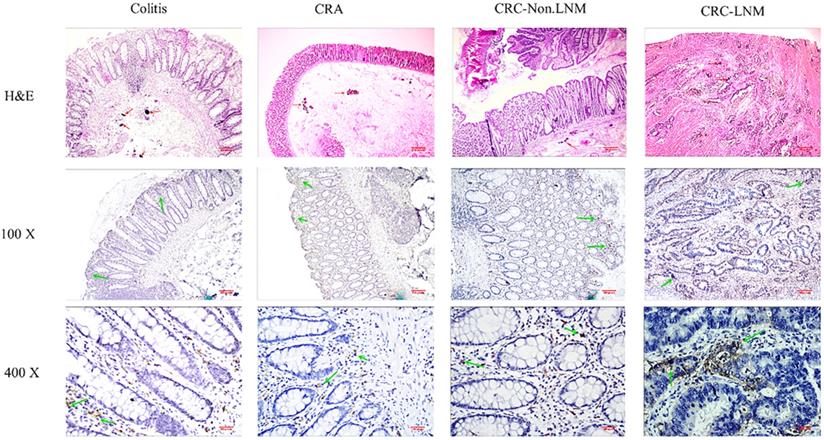 J Cancer Image