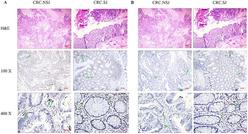 J Cancer Image