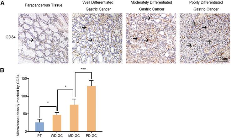 J Cancer Image